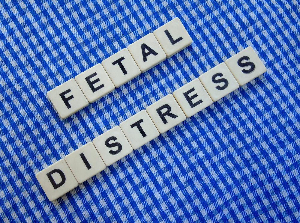 Fetal Distress Medical Malpractice